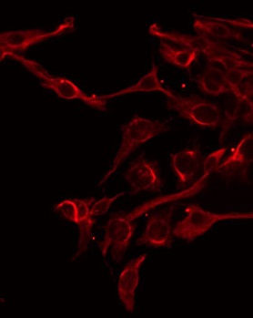 FAM3D Antibody - Staining HeLa cells by IF/ICC. The samples were fixed with PFA and permeabilized in 0.1% Triton X-100, then blocked in 10% serum for 45 min at 25°C. The primary antibody was diluted at 1:200 and incubated with the sample for 1 hour at 37°C. An Alexa Fluor 594 conjugated goat anti-rabbit IgG (H+L) Ab, diluted at 1/600, was used as the secondary antibody.