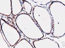 FAM40A Antibody - IHC of paraffin-embedded Human thyroid tissue using anti-FAM40A mouse monoclonal antibody.