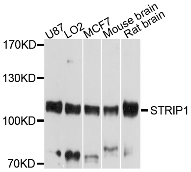 FAM40A Antibody - Western blot analysis of extracts of various cell lines, using STRIP1 antibody at 1:1000 dilution. The secondary antibody used was an HRP Goat Anti-Rabbit IgG (H+L) at 1:10000 dilution. Lysates were loaded 25ug per lane and 3% nonfat dry milk in TBST was used for blocking. An ECL Kit was used for detection and the exposure time was 20s.
