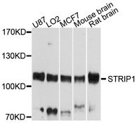 FAM40A Antibody - Western blot analysis of extracts of various cell lines, using STRIP1 antibody at 1:1000 dilution. The secondary antibody used was an HRP Goat Anti-Rabbit IgG (H+L) at 1:10000 dilution. Lysates were loaded 25ug per lane and 3% nonfat dry milk in TBST was used for blocking. An ECL Kit was used for detection and the exposure time was 20s.