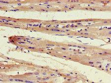 FAM43A Antibody - Immunohistochemistry of paraffin-embedded human heart tissue using FAM43A Antibody at dilution of 1:100