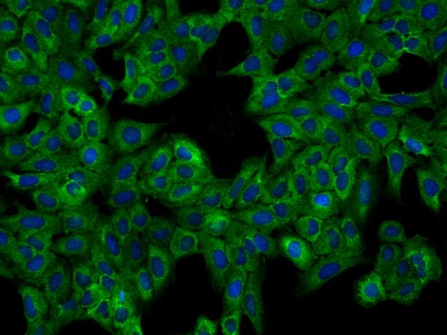 FAM43B Antibody - Immunofluorescence staining of FAM43B in U2OS cells. Cells were fixed with 4% PFA, permeabilzed with 0.3% Triton X-100 in PBS, blocked with 10% serum, and incubated with rabbit anti-Human FAM43B polyclonal antibody (dilution ratio 1:200) at 4°C overnight. Then cells were stained with the Alexa Fluor 488-conjugated Goat Anti-rabbit IgG secondary antibody (green) and counterstained with DAPI (blue). Positive staining was localized to Cytoplasm.