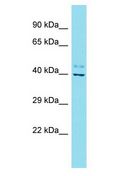 FAM45A Antibody - FAM45A antibody Western Blot of Fetal Lung. Antibody dilution: 1 ug/ml.  This image was taken for the unconjugated form of this product. Other forms have not been tested.