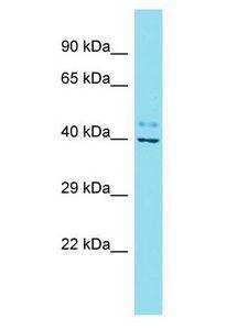 FAM45A Antibody - FAM45A antibody Western Blot of Fetal Lung. Antibody dilution: 1 ug/ml.  This image was taken for the unconjugated form of this product. Other forms have not been tested.