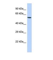 FAM46A Antibody - Western blot of Human HepG2. FAM46A antibody dilution 1.0 ug/ml.  This image was taken for the unconjugated form of this product. Other forms have not been tested.
