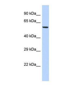 FAM46A Antibody - Western blot of Human HepG2. FAM46A antibody dilution 1.0 ug/ml.  This image was taken for the unconjugated form of this product. Other forms have not been tested.