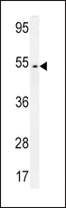 FAM46A Antibody - FAM46A Antibody western blot of CEM cell line lysates (35 ug/lane). The FAM46A antibody detected the FAM46A protein (arrow).