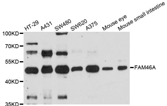 FAM46A Antibody - Western blot analysis of extracts of various cell lines, using FAM46A antibody at 1:3000 dilution. The secondary antibody used was an HRP Goat Anti-Rabbit IgG (H+L) at 1:10000 dilution. Lysates were loaded 25ug per lane and 3% nonfat dry milk in TBST was used for blocking. An ECL Kit was used for detection and the exposure time was 90s.