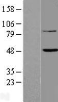 FAM46B Protein - Western validation with an anti-DDK antibody * L: Control HEK293 lysate R: Over-expression lysate