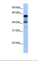 FAM46C Antibody - Fetal heart cell lysate. Antibody concentration: 1.0 ug/ml. Gel concentration: 12%.  This image was taken for the unconjugated form of this product. Other forms have not been tested.