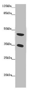 FAM46C Antibody - Western blot All Lanes :FAM46C antibody at 2 ug/ml+Mouse heart tissue Secondary Goat polyclonal to rabbit at 1/10000 dilution Predicted band size: 45 kDa Observed band size: 45,35 kDa