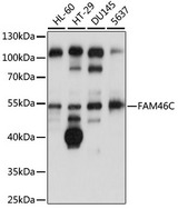 FAM46C Antibody - Western blot analysis of extracts of various cell lines, using FAM46C antibody at 1:1000 dilution. The secondary antibody used was an HRP Goat Anti-Rabbit IgG (H+L) at 1:10000 dilution. Lysates were loaded 25ug per lane and 3% nonfat dry milk in TBST was used for blocking. An ECL Kit was used for detection and the exposure time was 30s.