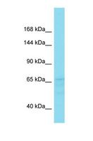 FAM47B Antibody - Western blot of Human Fetal Liver. FAM47B antibody dilution 1.0 ug/ml.  This image was taken for the unconjugated form of this product. Other forms have not been tested.