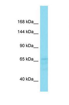 FAM47B Antibody - Western blot of Human Fetal Liver. FAM47B antibody dilution 1.0 ug/ml.  This image was taken for the unconjugated form of this product. Other forms have not been tested.