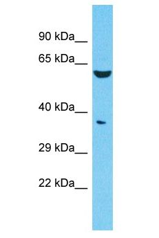 FAM47E Antibody - FAM47E antibody Western Blot of 721_B. Antibody dilution: 1 ug/ml.  This image was taken for the unconjugated form of this product. Other forms have not been tested.