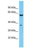 FAM47E Antibody - FAM47E antibody Western Blot of 721_B. Antibody dilution: 1 ug/ml.  This image was taken for the unconjugated form of this product. Other forms have not been tested.