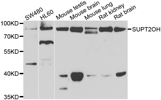 FAM48A / P38IP Antibody - Western blot analysis of extracts of various cell lines.