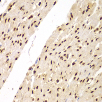 FAM48A / P38IP Antibody - Immunohistochemistry of paraffin-embedded human colon tissue.