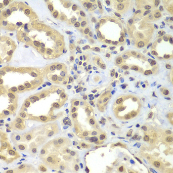 FAM48A / P38IP Antibody - Immunohistochemistry of paraffin-embedded human kidney tissue.