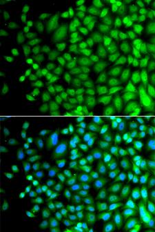 FAM48A / P38IP Antibody - Immunofluorescence analysis of A549 cells.