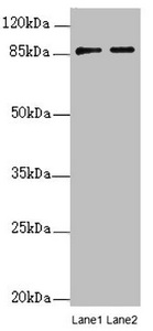 FAM48A / P38IP Antibody - Western blot All Lanes:SUPT20H antibody at 0.21ug/ml Lane 1 : Mouse lung tissue Lane 2 : Mouse kidney tissue Secondary Goat polyclonal to Rabbit IgG at 1/10000 dilution Predicted band size: 86,81,89 kDa Observed band size: 86 kDa