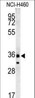FAM49A Antibody - FA49A Antibody western blot of NCI-H460 cell line lysates (35 ug/lane). The FA49A antibody detected FA49A protein (arrow).