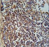 FAM49A Antibody - FA49A Antibody immunohistochemistry of formalin-fixed and paraffin-embedded human lymph tissue followed by peroxidase-conjugated secondary antibody and DAB staining.