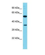 FAM49A Antibody - Western blot of FAM49A Antibody - C-terminal region with human ACHN cells lysate.  This image was taken for the unconjugated form of this product. Other forms have not been tested.