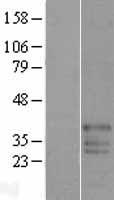 FAM50B Protein - Western validation with an anti-DDK antibody * L: Control HEK293 lysate R: Over-expression lysate