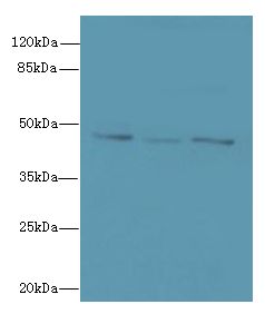 FAM53B Antibody - Western blot. All lanes: FAM53B antibody at 2 ug/ml. Lane 1: MCF7 whole cell lysate. Lane 2: A549 whole cell lysate. Lane 3: HCT116 whole cell lysate. Secondary antibody: Goat polyclonal to Rabbit IgG at 1:10000 dilution. Predicted band size: 46 kDa. Observed band size: 46 kDa.