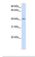 FAM54A / DUFD1 Antibody - Fetal muscle lysate. Antibody concentration: 1.0 ug/ml. Gel concentration: 12%.  This image was taken for the unconjugated form of this product. Other forms have not been tested.