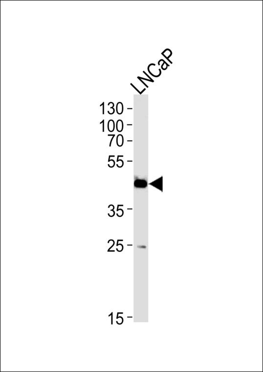 FAM54A / DUFD1 Antibody - FAM54A Antibody western blot of LNCaP cell line lysates (35 ug/lane). The FAM54A antibody detected the FAM54A protein (arrow).