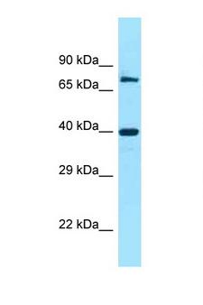 FAM54A / DUFD1 Antibody - FAM54A antibody Western blot of 721_B Cell lysate. Antibody concentration 1 ug/ml.  This image was taken for the unconjugated form of this product. Other forms have not been tested.