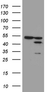 FAM54A / DUFD1 Antibody - HEK293T cells were transfected with the pCMV6-ENTRY control. (Left lane) or pCMV6-ENTRY FAM54A. (Right lane) cDNA for 48 hrs and lysed. Equivalent amounts of cell lysates. (5 ug per lane) were separated by SDS-PAGE and immunoblotted with anti-FAM54A. (1:500)