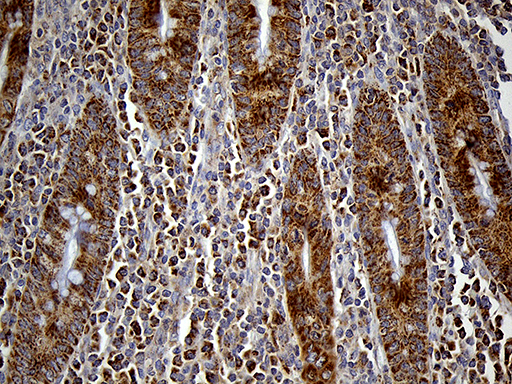 FAM54A / DUFD1 Antibody - Immunohistochemical staining of paraffin-embedded Human appendix tissue within the normal limits using anti-FAM54A mouse monoclonal antibody. (Heat-induced epitope retrieval by 1mM EDTA in 10mM Tris buffer. (pH8.5) at 120°C for 3 min. (1:150)