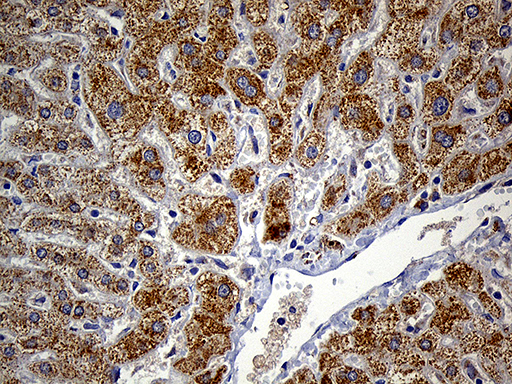 FAM54A / DUFD1 Antibody - Immunohistochemical staining of paraffin-embedded Human liver tissue within the normal limits using anti-FAM54A mouse monoclonal antibody. (Heat-induced epitope retrieval by 1mM EDTA in 10mM Tris buffer. (pH8.5) at 120°C for 3 min. (1:150)