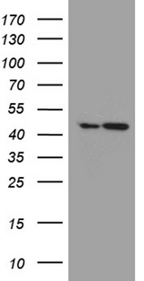 FAM54A / DUFD1 Antibody - HEK293T cells were transfected with the pCMV6-ENTRY control. (Left lane) or pCMV6-ENTRY FAM54A. (Right lane) cDNA for 48 hrs and lysed