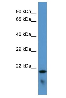 FAM57B Antibody - FAM57B antibody Western Blot of HeLa. Antibody dilution: 1 ug/ml.  This image was taken for the unconjugated form of this product. Other forms have not been tested.