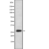 FAM58A Antibody - Western blot analysis of FA58A expression in HEK293 cells. The lane on the left is treated with the antigen-specific peptide.