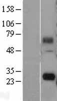 FAM60A Protein - Western validation with an anti-DDK antibody * L: Control HEK293 lysate R: Over-expression lysate