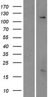 FAM62C / ESYT3 Protein - Western validation with an anti-DDK antibody * L: Control HEK293 lysate R: Over-expression lysate