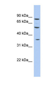 FAM63A Antibody - FAM63A antibody Western blot of Fetal liver lysate. This image was taken for the unconjugated form of this product. Other forms have not been tested.