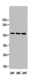 FAM63A Antibody - Western blot All lanes: MINDY1 antibody at 8µg/ml Lane 1: Mouse liver tissue Lane 2: A549 whole cell lysate Lane 3: HepG2 whole cell lysate Secondary Goat polyclonal to rabbit IgG at 1/10000 dilution Predicted band size: 52, 37, 57, 42 kDa Observed band size: 52 kDa