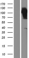 FAM63B Protein - Western validation with an anti-DDK antibody * L: Control HEK293 lysate R: Over-expression lysate