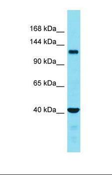 FAM65A Antibody - Western blot of Placenta. FAM65A antibody dilution 1.0 ug/ml.  This image was taken for the unconjugated form of this product. Other forms have not been tested.