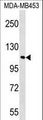 FAM65B / DIFF48 Antibody - FAM65B Antibody western blot of MDA-MB453 cell line lysates (35 ug/lane). The FAM65B antibody detected the FAM65B protein (arrow).