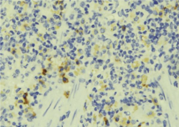 FAM65B / DIFF48 Antibody - 1:100 staining human lymph tissue by IHC-P. The sample was formaldehyde fixed and a heat mediated antigen retrieval step in citrate buffer was performed. The sample was then blocked and incubated with the antibody for 1.5 hours at 22°C. An HRP conjugated goat anti-rabbit antibody was used as the secondary.