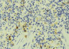 FAM65B / DIFF48 Antibody - 1:100 staining human lymph tissue by IHC-P. The sample was formaldehyde fixed and a heat mediated antigen retrieval step in citrate buffer was performed. The sample was then blocked and incubated with the antibody for 1.5 hours at 22°C. An HRP conjugated goat anti-rabbit antibody was used as the secondary.