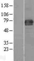 FAM65B / DIFF48 Protein - Western validation with an anti-DDK antibody * L: Control HEK293 lysate R: Over-expression lysate