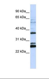 FAM70A Antibody - Jurkat cell lysate. Antibody concentration: 1.0 ug/ml. Gel concentration: 12%.  This image was taken for the unconjugated form of this product. Other forms have not been tested.